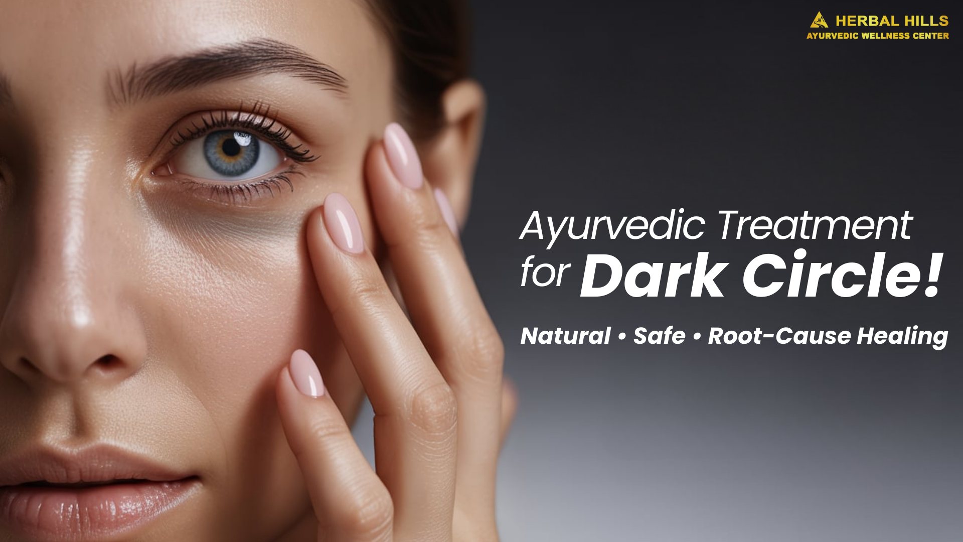 Close-up of a woman touching her under-eye area, highlighting Ayurvedic treatment for dark circles with natural and root-cause healing.