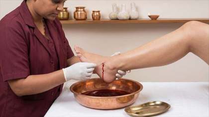 Raktamokshana – Siravedh – one of the Ayurvedic therapies at Herbal Hills Center, Mumbai